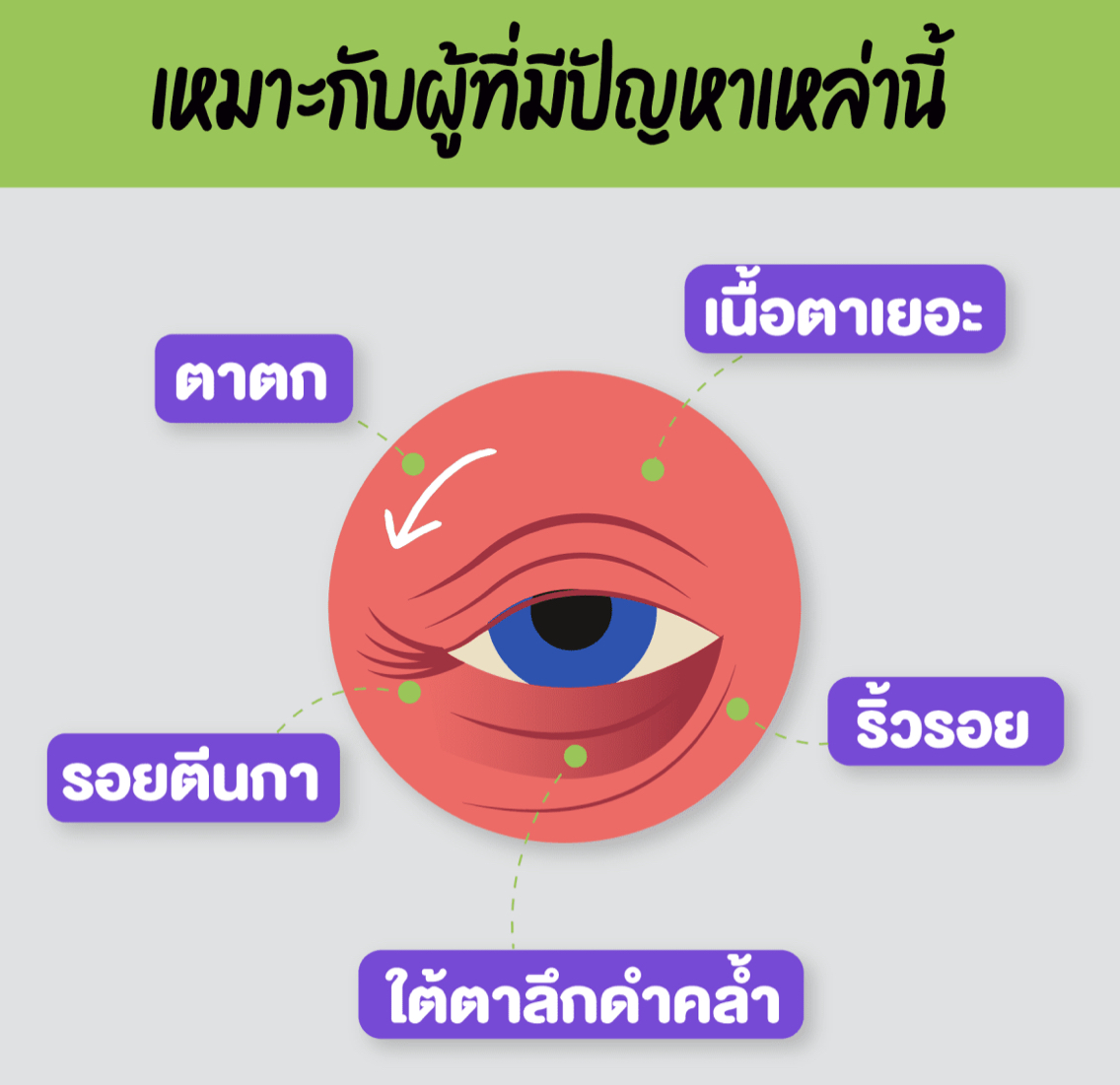 thermage_thermageeye_thermageตา_pongsakclinic 
