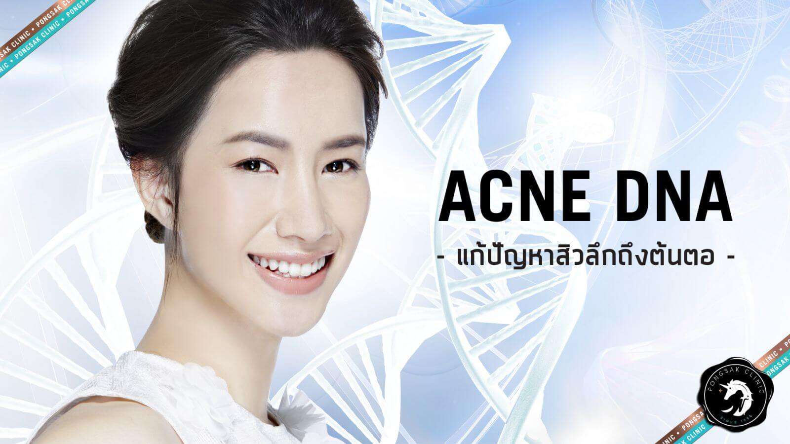 Acne DNA